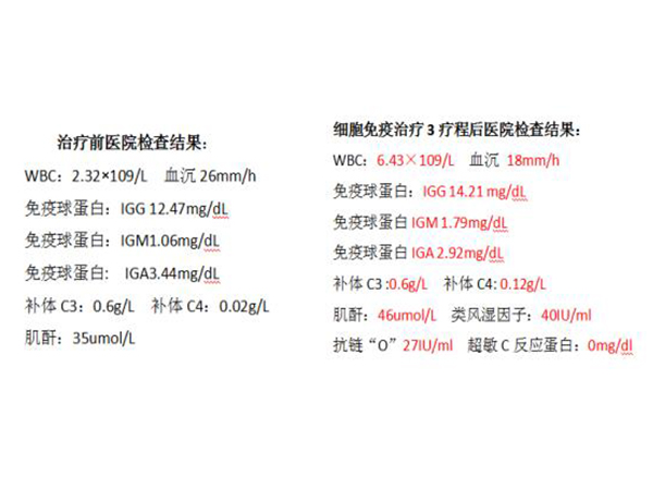 系统性红斑狼疮6年